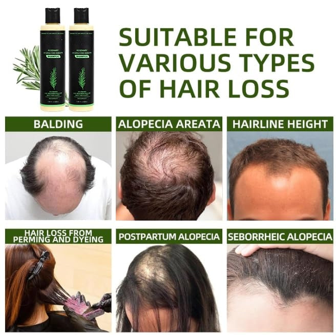 ROSEMARY SHAMPOO - NATURAL HAIR RENEWAL