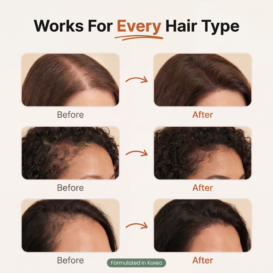 🔥Hot sale 49% OFF 🔥 Korean Hair Growth Serum for Thinning Hair & Shedding