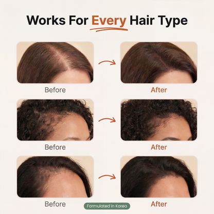 🔥Hot sale 49% OFF 🔥 Korean Hair Growth Serum for Thinning Hair & Shedding