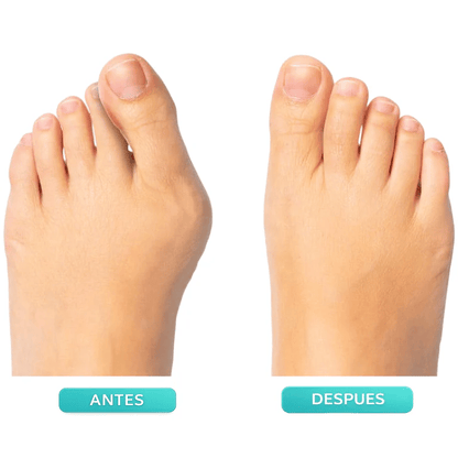 Father's Day Deal 👣Adjustable Bunion Corrector