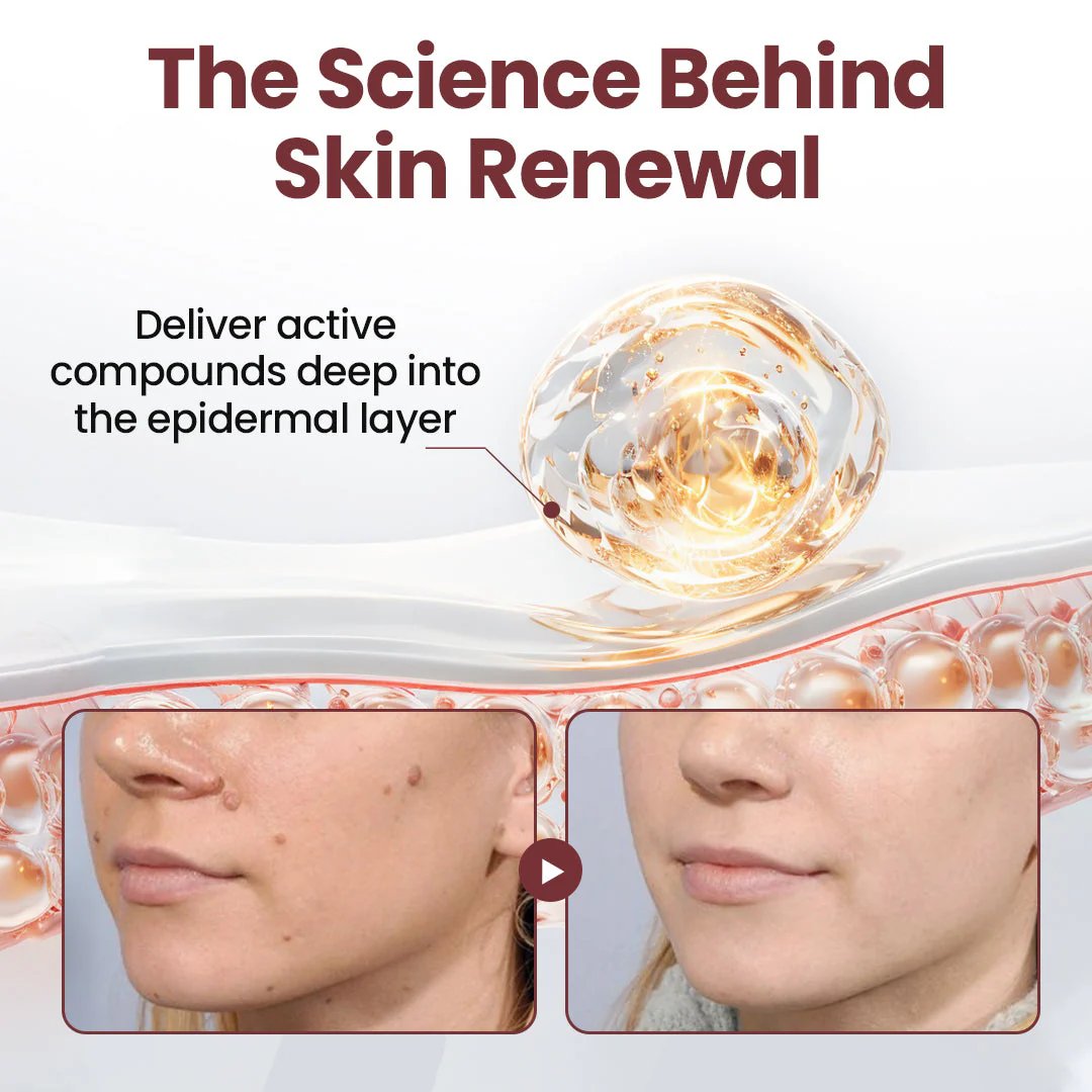 KeraErase Dual-Action Renewal Cream