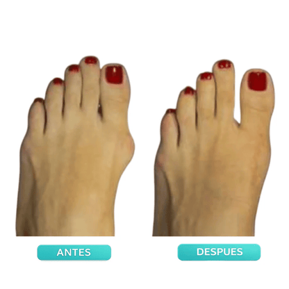 Father's Day Deal 👣Adjustable Bunion Corrector