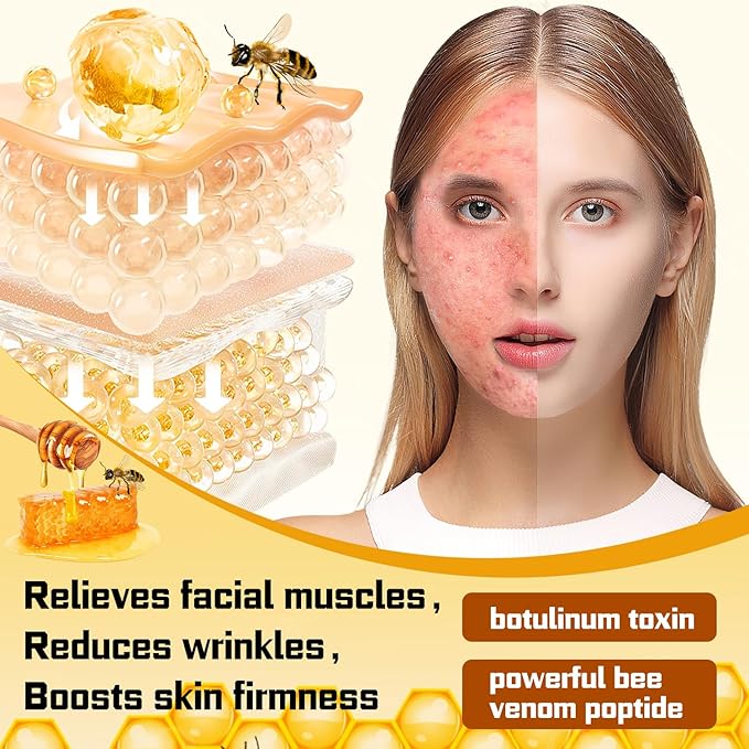 ✨Bee venom Comprehensive Cream
