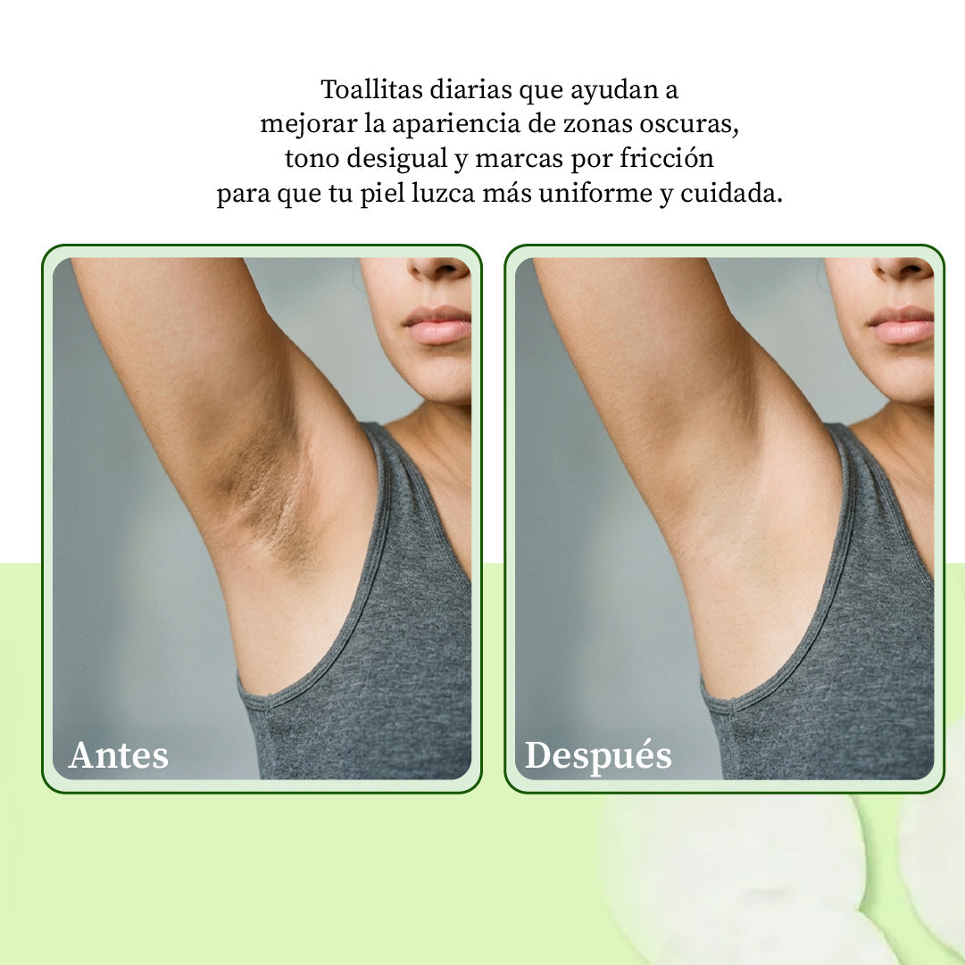 🔥LAST DAY SALE 40% OFF-🔥 JIYU | Moisturising and Lightening Pads for Underarms and Bikini Line
