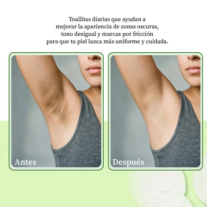 🔥LAST DAY SALE 40% OFF-🔥 JIYU | Moisturising and Lightening Pads for Underarms and Bikini Line