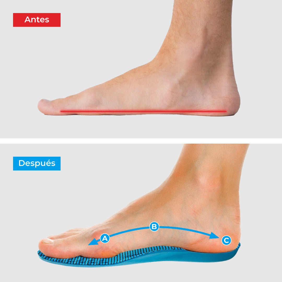 ComfyFeet Insoles - Enjoy pain-free days